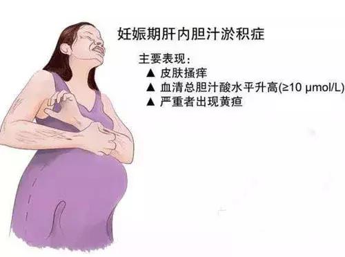 孕后期皮肤痒胆汁淤积症,孕晚期皮肤痒总胆汁酸正常