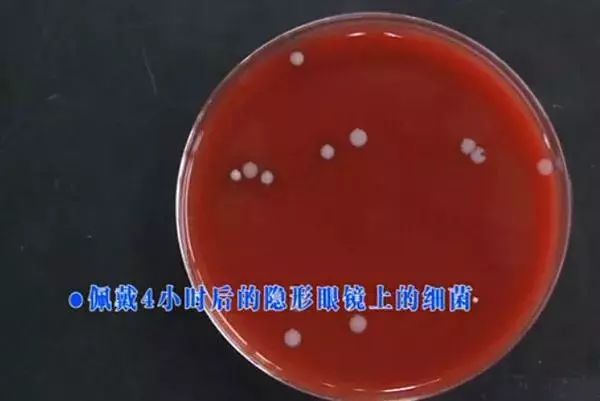 美瞳真的有这么可怕吗 (美瞳能毁掉双眼吗)