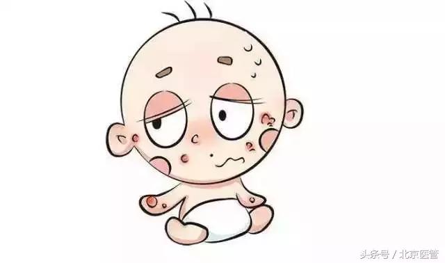 宝宝身上起疹子痒睡不着怎么缓解,宝宝温度高身上痒起红疹子