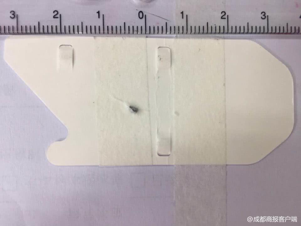 右眼被铁屑砸中后失明算重疾病吗,铁屑进了眼睛不取出来能恢复吗