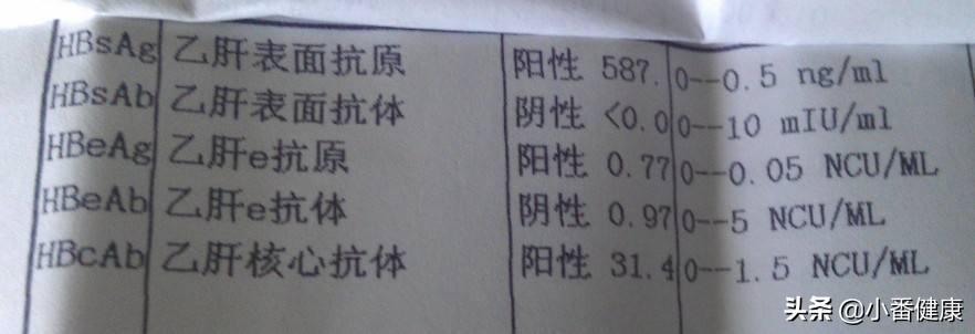 转氨酶高排除乙肝还需要查什么,谷丙转氨酶偏高是否能确定有乙肝