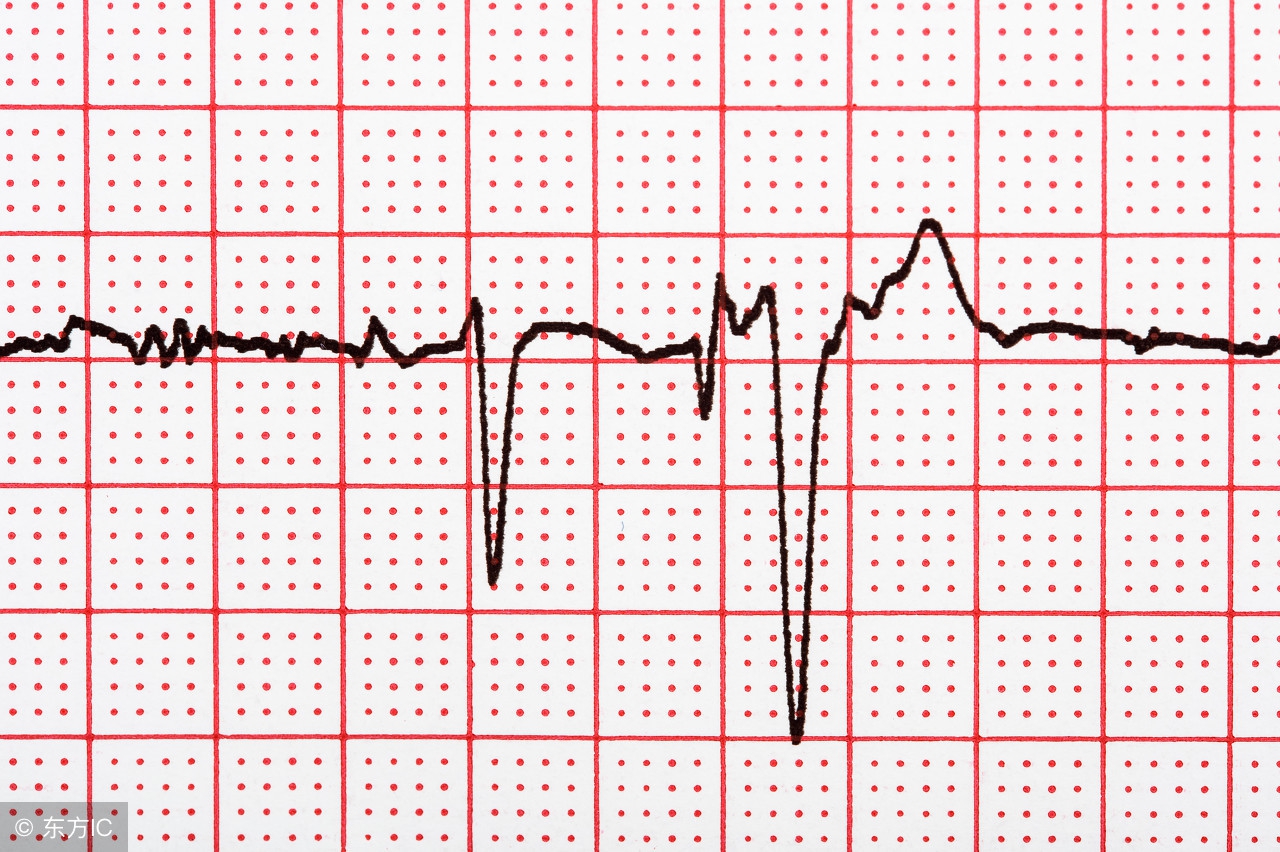 风心病出现房颤怎么办,房颤该怎么办