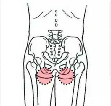 坐骨结节与坐骨神经解剖,坐骨神经结节痛治疗最好的方法