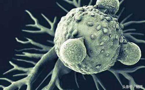 父母患癌了要怎么面对,父母都有肿瘤是什么原因造成