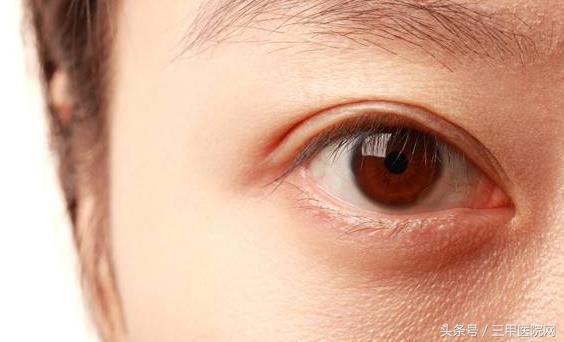 沙眼不治的后果是什么,沙眼要去眼科医院治疗吗