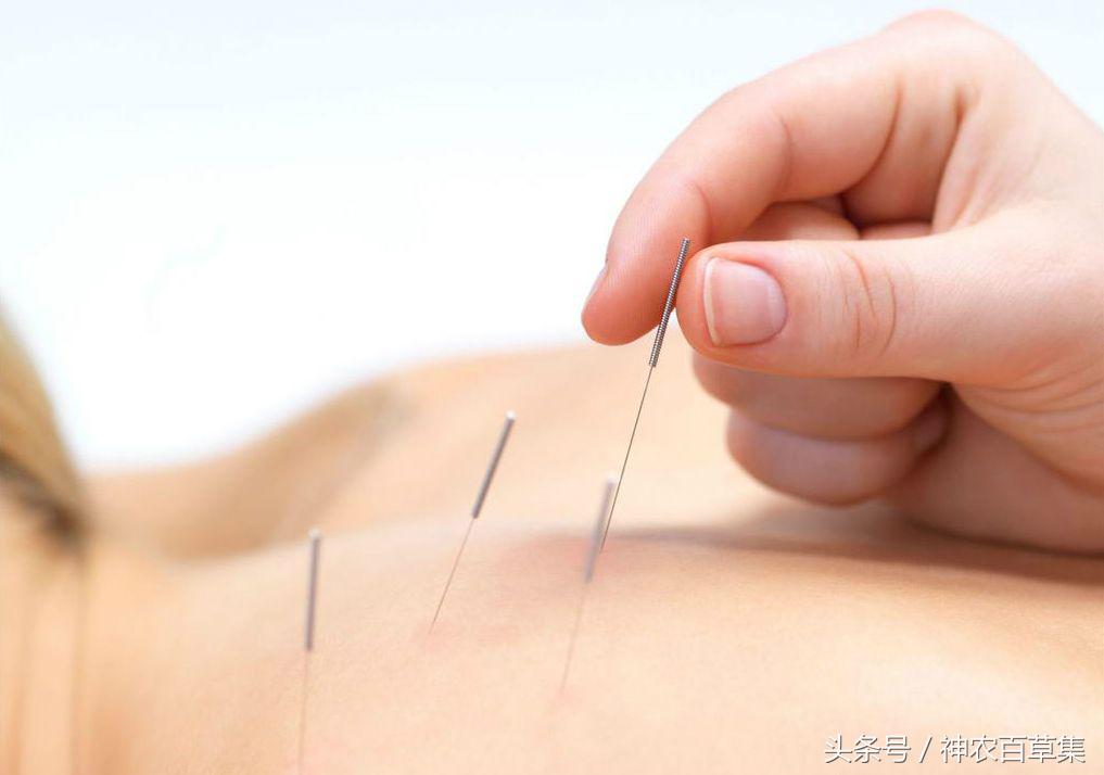 趣说中国医学史：针灸铜人与王惟一