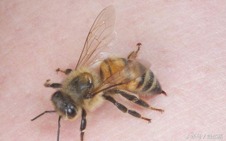 被蜜蜂蛰了针拔不出来怎么办,蜜蜂蜇人后的毒针怎么拔出来