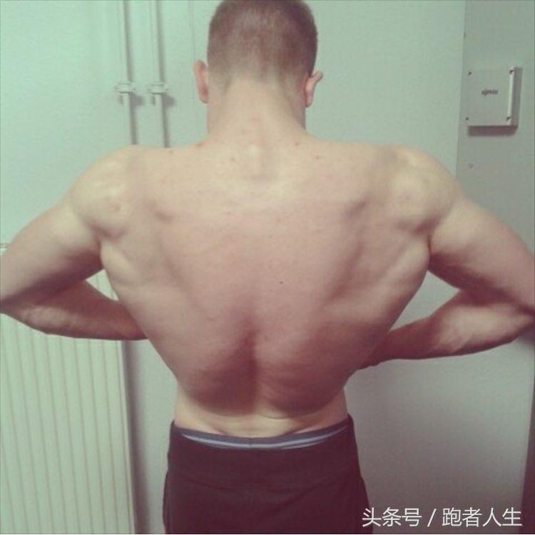 一个动作改善臀部两边塌陷,臀部两侧塌陷的原因