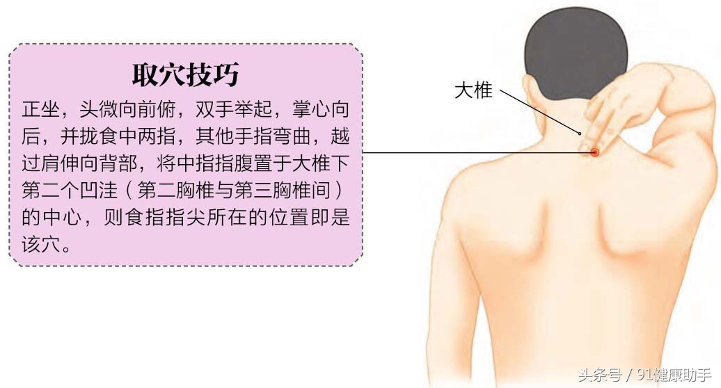 风池穴风府穴颈椎病按摩多长时间,脖子受风了按什么穴位