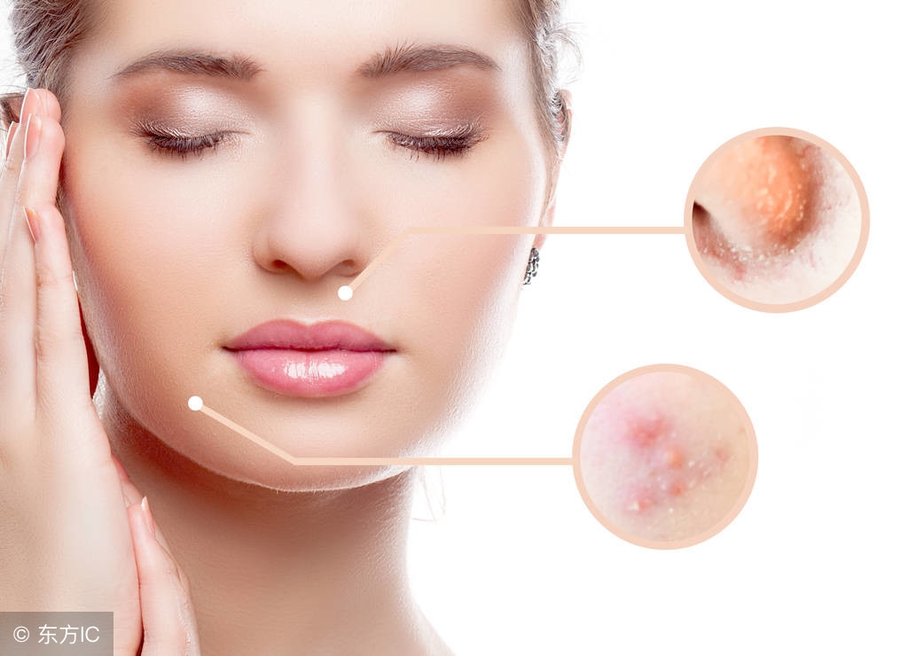 怎样才能消除痘,怎样才能彻底消除痘