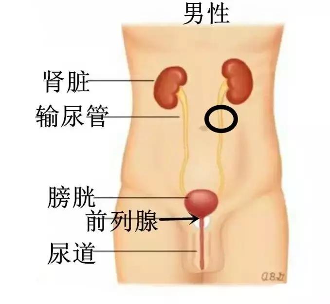肾有结石要怎样运动才掉石头,一颗小石头毁掉一颗肾