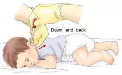 妈妈须知丨这些给孩子滴药水的这些“姿势”你都会吗？