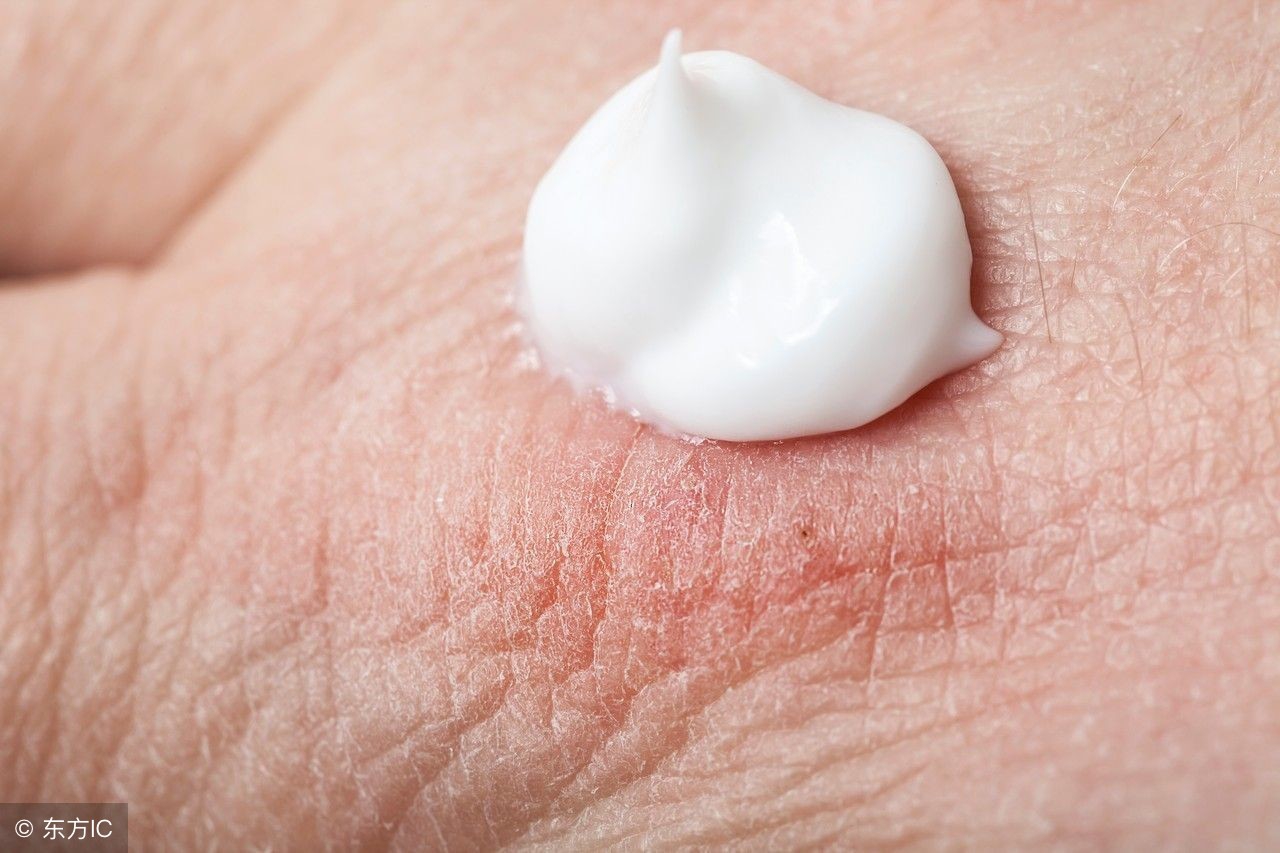 导致异位性皮炎的病因有哪些,异位性皮炎是什么样的症状