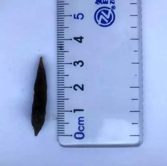 误吞了枣核该吃什么,误吞了枣核要吃什么