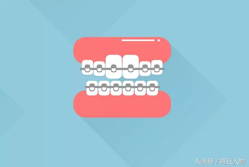 人到中年牙都会松动吗,刚戴上牙套的感受