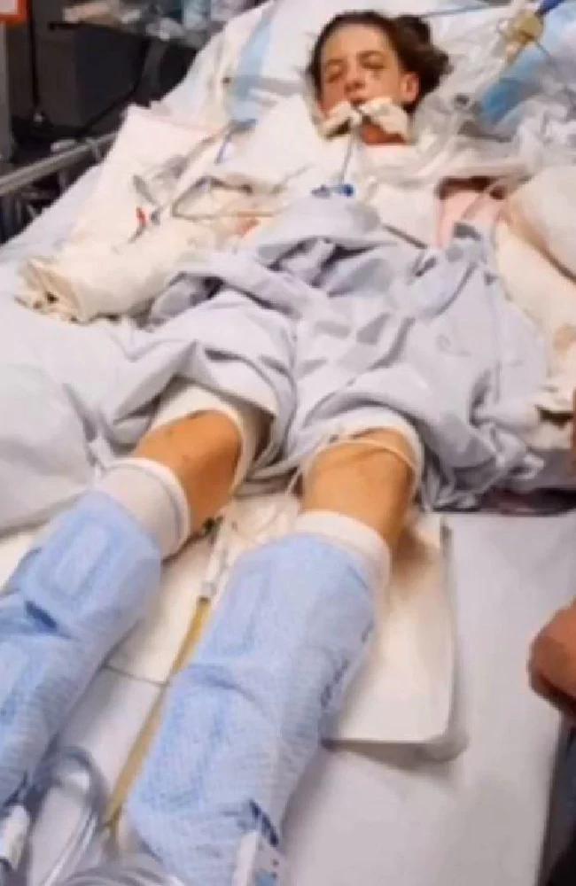 交友不慎！澳大利亚少女惨遭渣男泼汽油惨变“火球”