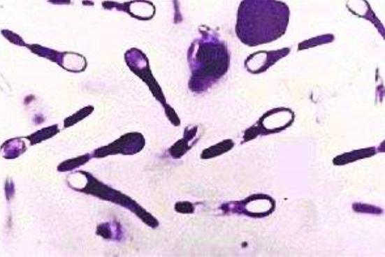 得了破伤风再打破伤风针有用吗,打了破伤风针之后会感染破伤风吗