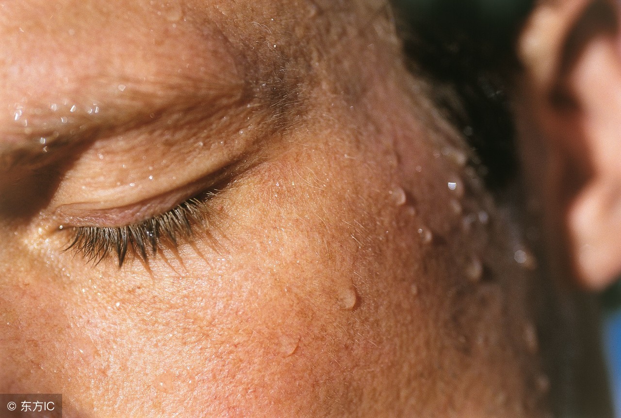 巨细胞和单纯疱疹病毒如何预防,单纯疱疹病毒hsv1型是怎么感染的