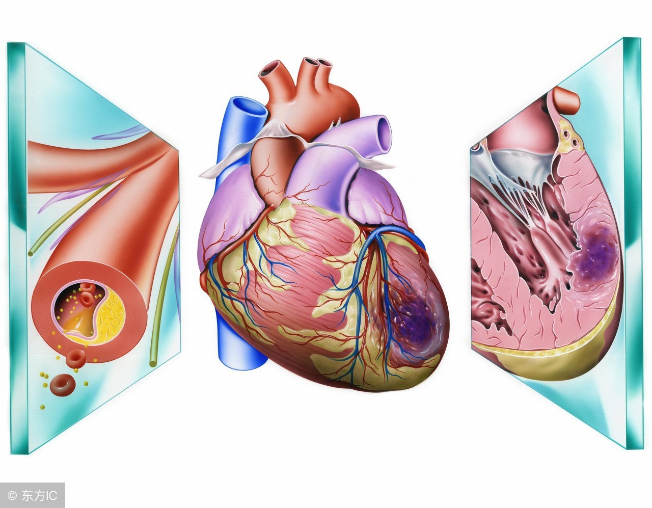 雌激素缺乏会引起哪些妇科病,雌激素低为什么引起心血管疾病