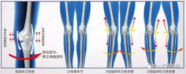 瑜伽纠正脚的正位,瑜伽改善走路外八字脚