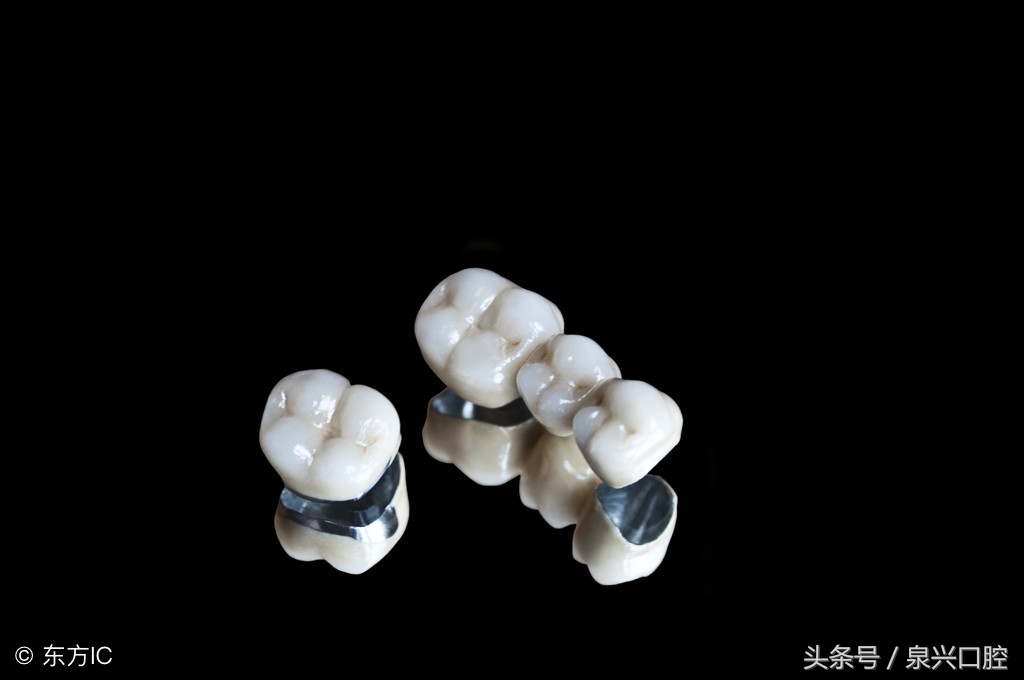 全烤瓷牙有什么风险和后遗症,烤瓷牙都有哪些危害及注意事项