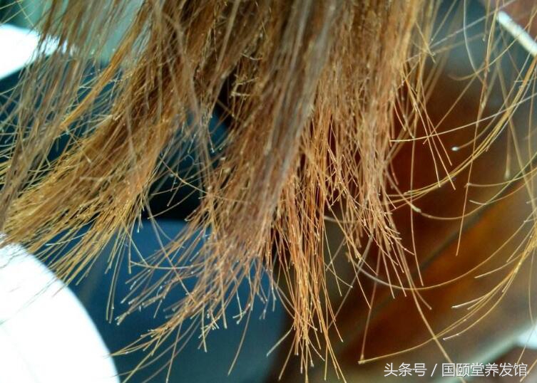 国颐堂：头发分叉怎么办，7招帮你重塑柔顺