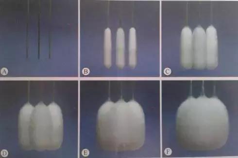 冷冻治疗癌症的成功率,中国最新冰冻治疗癌症技术