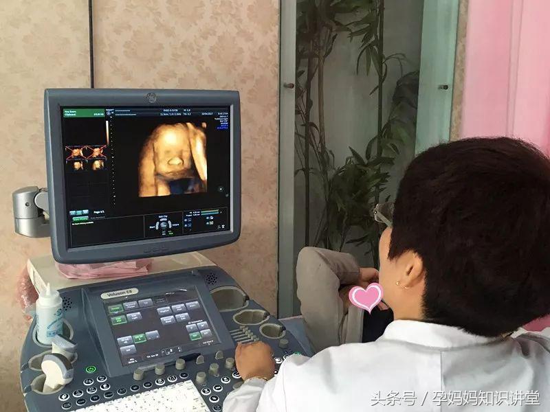 大排畸四维彩超宝宝不配合怎么办,四维彩超大排畸怎么样才算正常