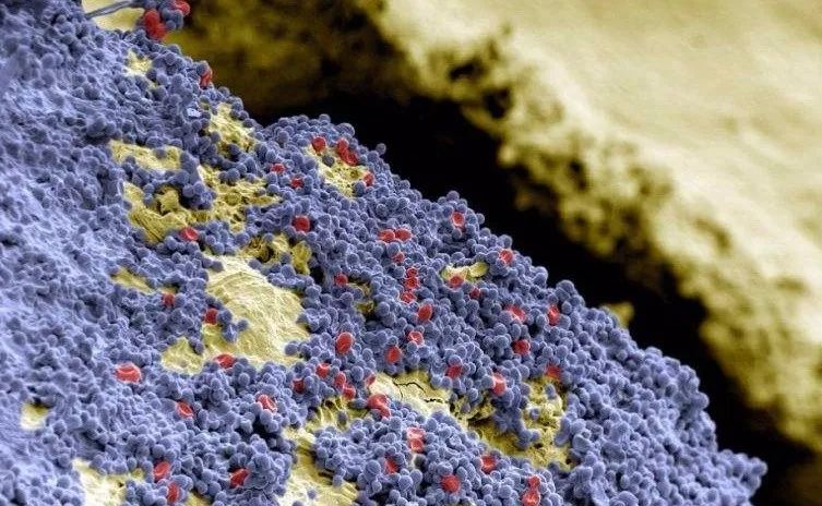 吃完螃蟹可以喝酸奶和牛奶吗,螃蟹和酸奶一起吃中毒