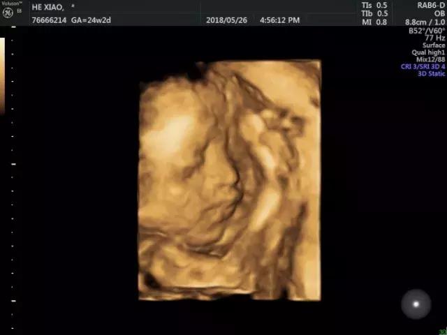 第一次当爸爸你比谁都优秀,我也是第一次当爸爸中文配音