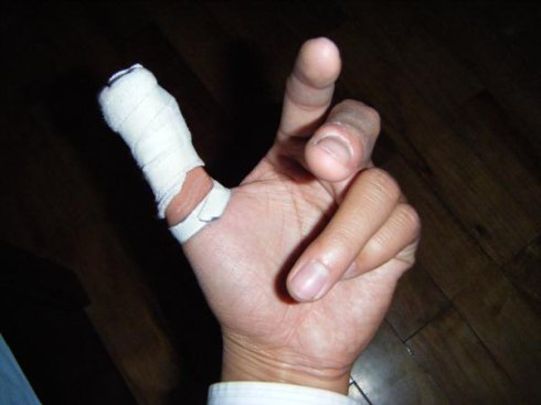 被a4纸划破是什么原因,为什么被a4纸划伤会更痛