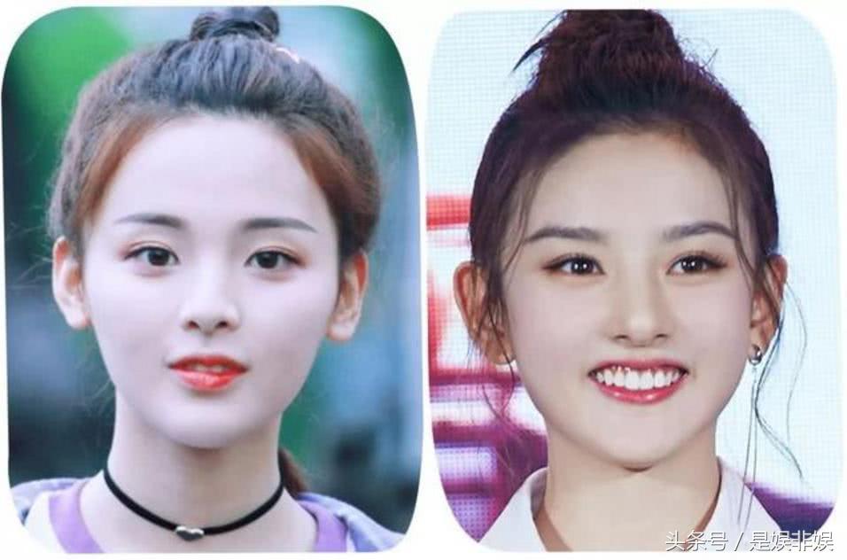 有没有觉得紫宁长得很像戚薇,戚薇有多像张紫宁