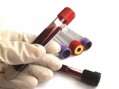 爱心献血怎么提高成功率,一招提高献血成功率