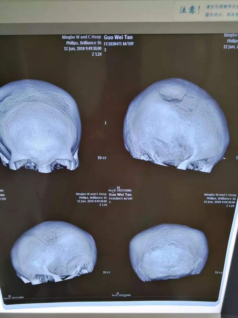 心痛7岁男童11楼坠亡,痛心10岁男孩从24楼跌落在住户家