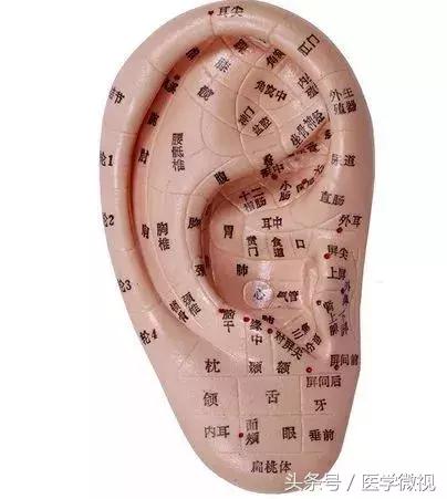 打耳洞真的对视力好吗,打耳洞能引起近视眼吗