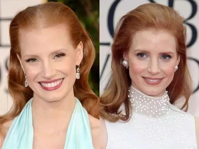 脱发、发际线高、地中海的克星！用它，1个月头发不掉了，不痒了，半年变浓密