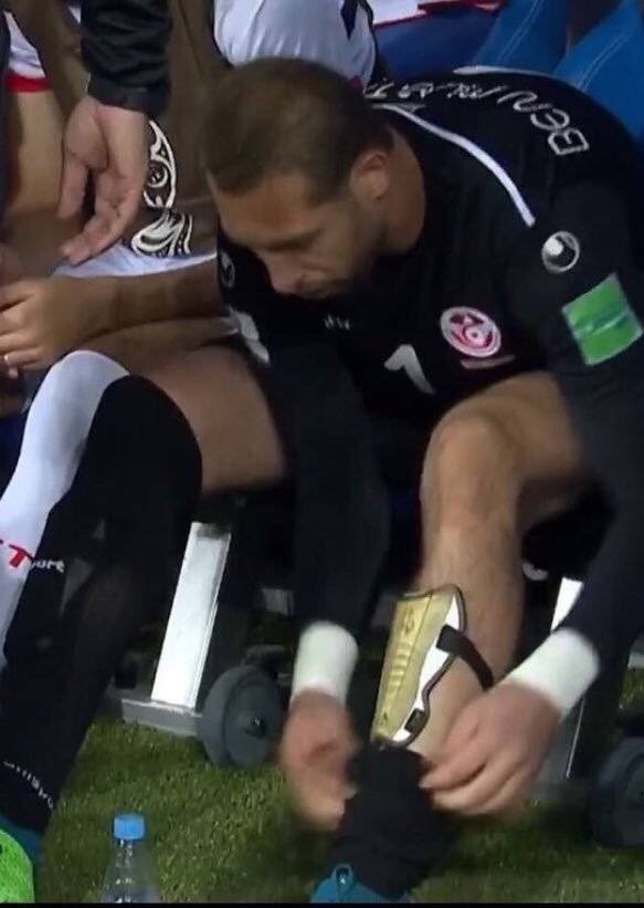 足球常见的运动损伤有哪几种,足球运动中常见的运动损伤及预防