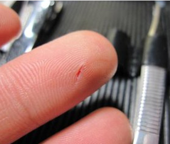 夏天来了脱皮,夏天会变成油皮吗