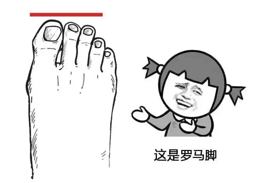 畸形脚型,看脚型分辨你适合穿怎样的鞋子
