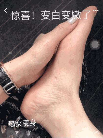 擦掉一张皮，双脚换皮术！死皮、老茧一喷就没，15秒还原嫩白玉足！