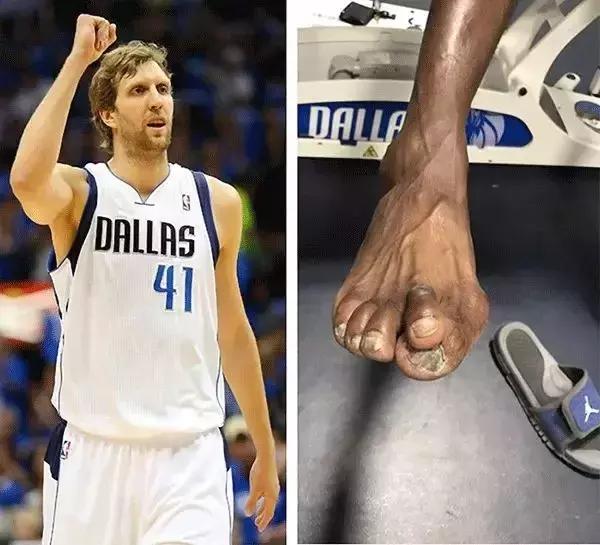 校园｜职业和业余的区别究竟有多恐怖？看看荣誉背后的这遍体鳞伤