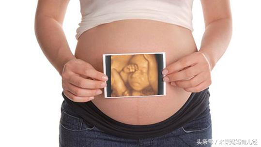 怀孕期做个四维彩超一般多少费用,怀孕几个月做四维大概多少钱