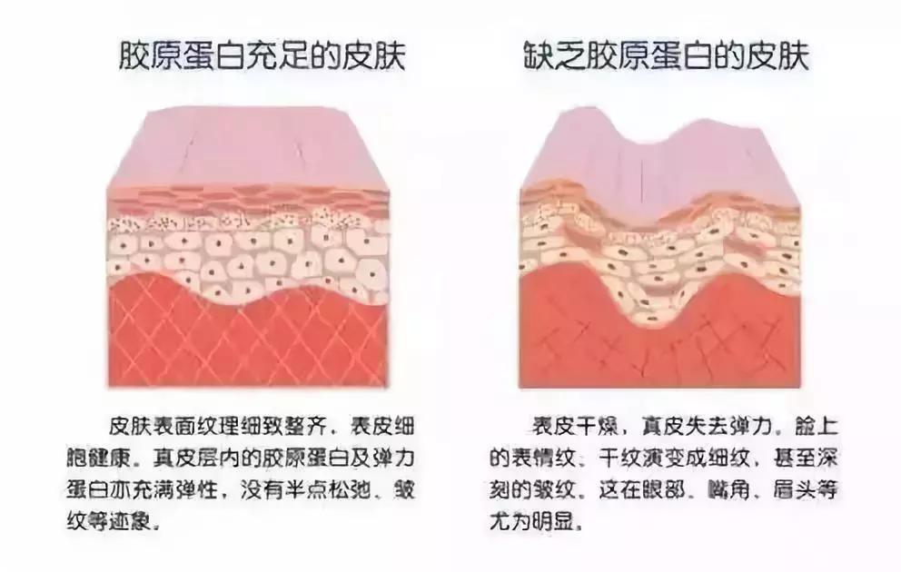 晒后修护需要吗,晒后修复冻膜吗