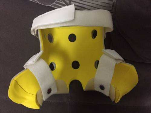 小孩臀纹不对称跛行,宝宝腿纹对称臀纹不对称做什么操