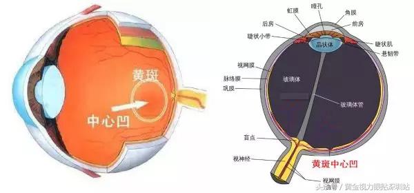 黄斑病变是眼癌吗,致眼盲疾病有哪些