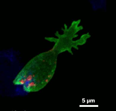 细胞免疫治疗肿瘤什么时间推行的,细胞免疫治疗学