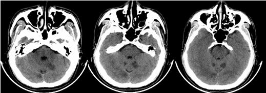 心血管内科急救流程,急诊静脉用药方法