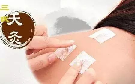 今年中医三伏灸时间表,一年三伏灸最佳黄金时间表