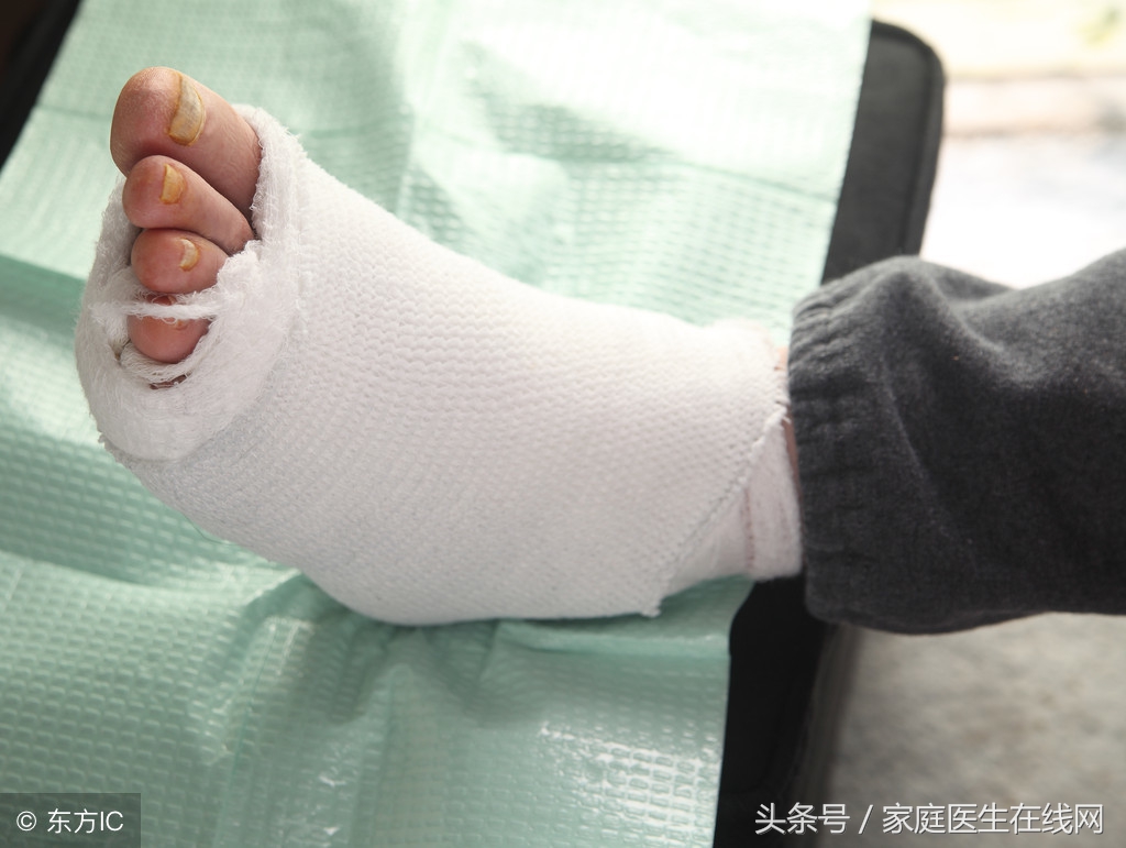 如果不想得糖尿病不能吃哪些食物,不想得糖尿病需要注意哪些事项