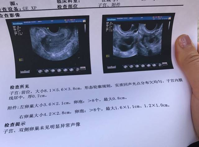 什么样的卵泡需要促排,什么样的卵泡才能取出来